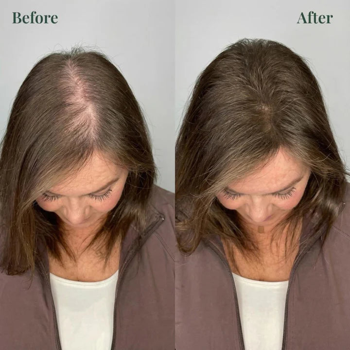 Kerarose™ Rosemary Shampoo